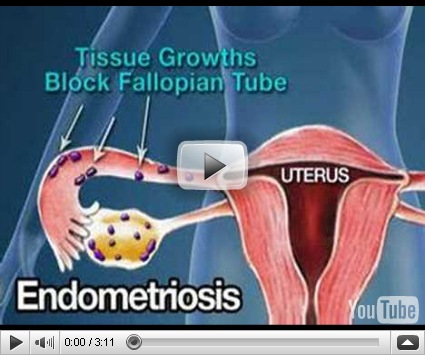 asian pacific american times colorado secondary infertility no sperm